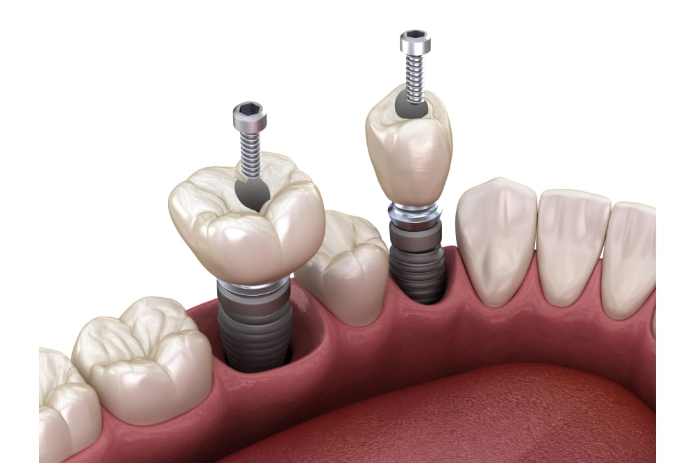 Dentzz Dentistry at work